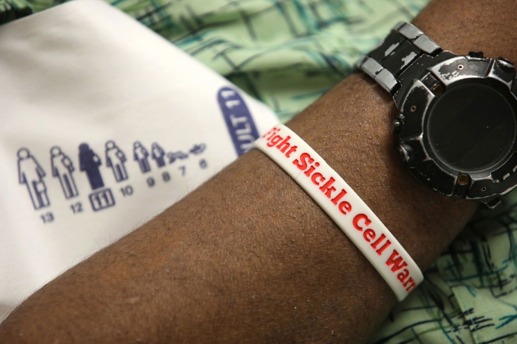 Sickle Cell Gene Therapy , Cure